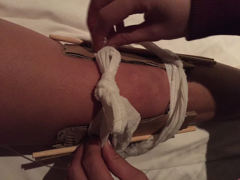 My sad knee immobilizer (chopsticks upgrade by Sylvie)